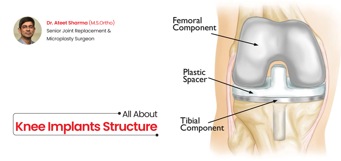 Hip Dysplasia - Do You Need Surgery