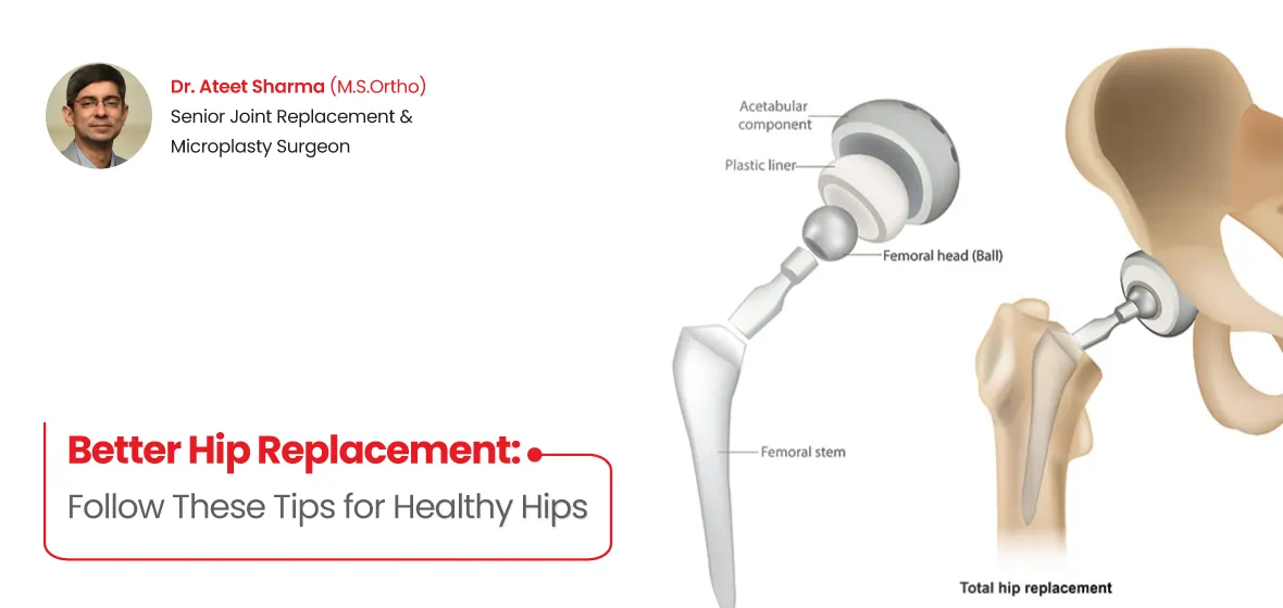 better hip replacement