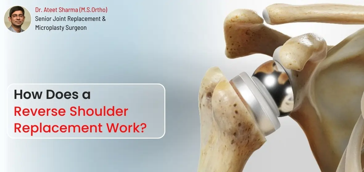 how does a reverse shoulder replacement work