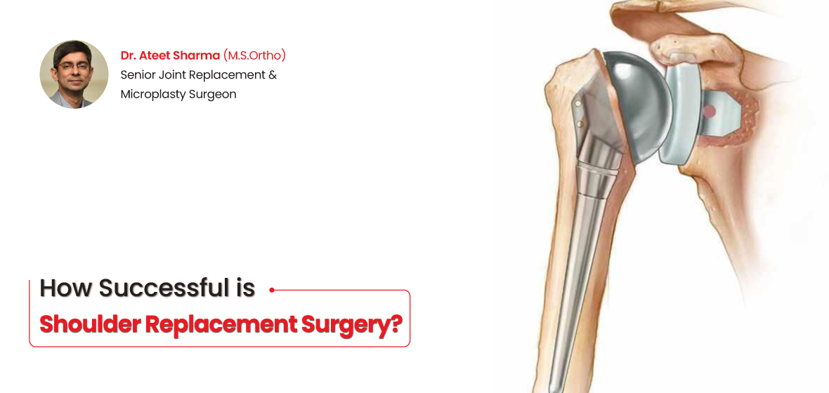 all about knee implants structure