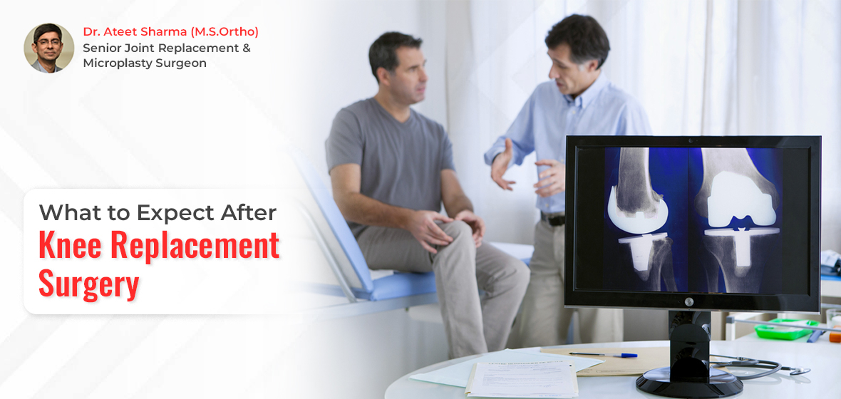  what to expect after knee replacement