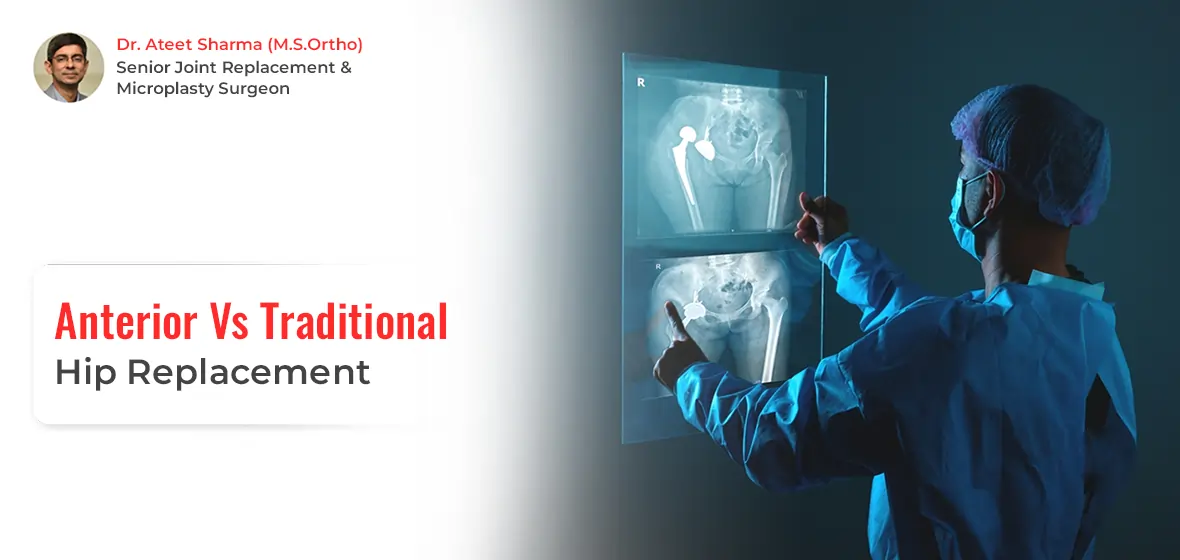 what to expect after knee replacement