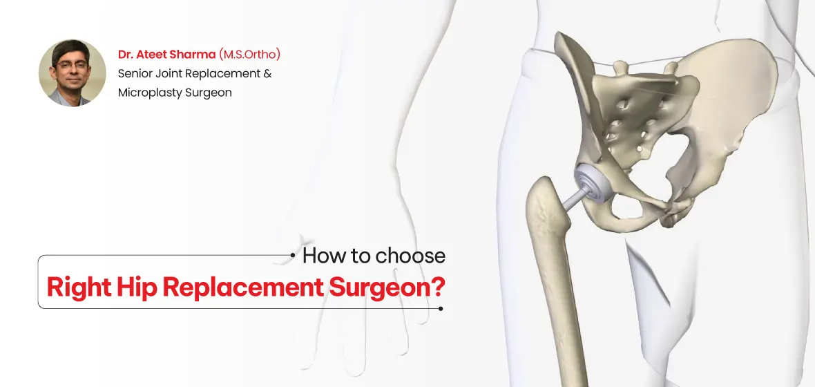 what to expect after knee replacement