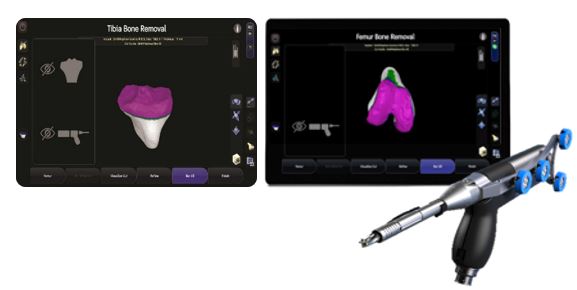 SmithNephews-CORI-Surgical-System