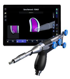 SmithNephews-CORI-Surgical-System