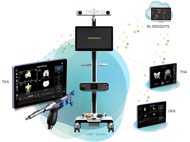 SmithNephews-CORI-Surgical-System